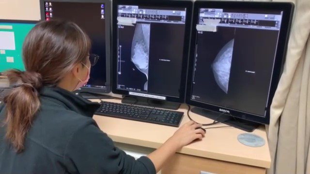 乳癌不可輕忽 3D乳房斷層攝影減疼痛升準確率