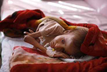 葉門內戰因封鎖而造成的饑荒，誰的責任？ 圖／路透社