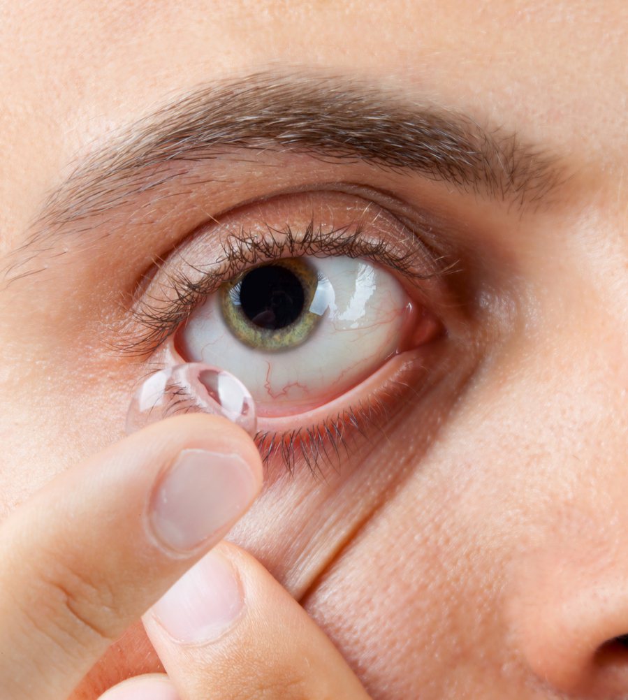 連續戴隱形眼鏡十小時，甚至更久，可能傷害眼角膜。除了感到劇痛以外，這種傷害可導致...