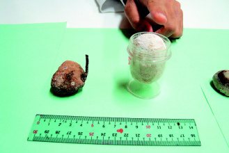 黃志平醫師自八旬老翁體內取出的多顆尿路結石，最大的有5、6公分，有如一顆雞蛋。（記者胡宗鳳／攝影）