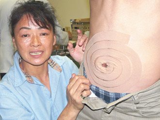 國立台灣體育大學（台中）副教授駱明瑤研究發現，運動員用來治療運動傷害的肌內效貼布，有減肥效果，貼在肚臍四周連續兩個月，可消除「鮪魚肚」。（記者林秀美／攝影）