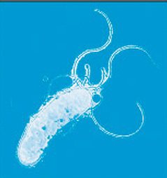 幽門螺旋桿菌外觀有數根鞭毛，可螺旋狀前進，因此得名。澳洲醫師貝利馬歇爾和羅賓華倫...