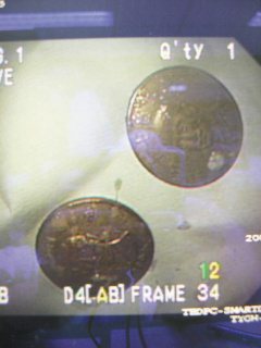 一名失智症患者吞下10、50元2枚硬幣，於胸部Ｘ光攝影清晰可見。（記者胡宗鳳／攝影）