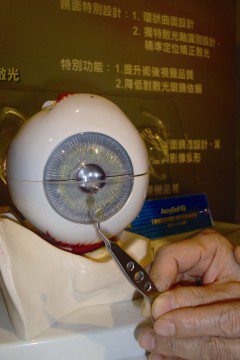 台灣每年因白內障須換置人工水晶體的病例已超過13萬例，最新核准上市的「3A全寬頻」多焦點黃色人工水晶體，可矯正近視與老花眼，讓患者摘掉眼鏡。（記者胡宗鳳）