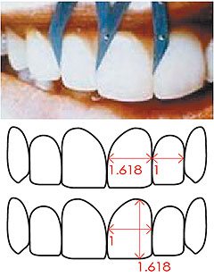 依照審美觀點，單顆牙齒寬度與高度比或牙齒排列若符合黃金比例1：1.618，最為美觀。
圖／陳雅怡醫師提供