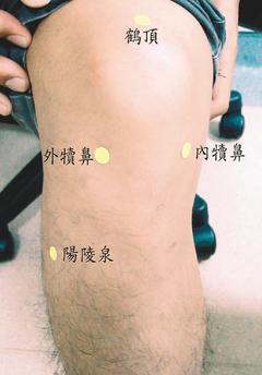 膝關節疼痛時，可按壓周邊穴位緩解。 圖／江佩蓉醫師提供非報系