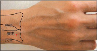 養老穴：掌心向下，用另一手食指按在尺骨小頭（手腕背面外上方的高骨）的最高點上，食指尖對在尺骨小頭的橈側（大姆指側）；然後掌心轉向胸部，當食指尖滑入的凹陷處，穴位在尺骨邊。 圖／許禎育醫師提供