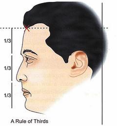 圖1：下巴至鼻尖、鼻尖至兩眉中間、兩眉中間至髮線，各占同樣長度，由此設定髮線位置。 圖／吳文藝醫師提供