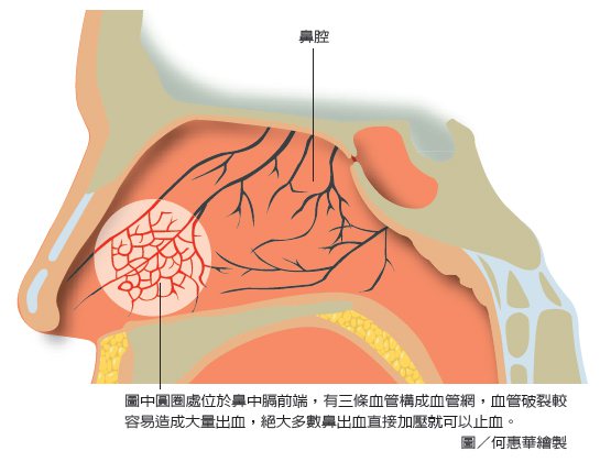 圖中圓圈處位於鼻中膈前端，有三條血管構成血管網，血管破裂較容易造成大量出血，絕大多數鼻出血直接加壓就可以止血。
 圖／何惠華繪製