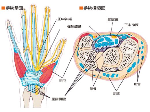 圖1。腕隧道位於手腕掌面，由腕骨和其上橫腕韌帶形成，通常骨是凹形，頂部有橫腕韌帶蓋住，成為隧道。在隧道中，有正中神經、屈指肌群及屈拇長肌肌腱通過，當橫腕韌帶覆蓋過緊、肌腱發炎或因其它因素壓迫到正中神經，就造成腕隧道症候群。 圖／黃麗文提供