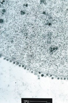 透過電子顯微鏡看到冠狀病毒正在入侵肺部組織的狀況，圖中呈數個小圓點聚集，那是已發育成熟正待釋放的病毒。 （路透）