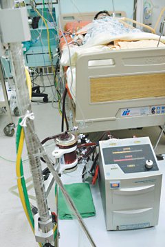 擁有高知名度的葉克膜體外循環機「葉醫師」，到底用來救命還是保存器官，仍有不少爭議。<br>
本報資料照片