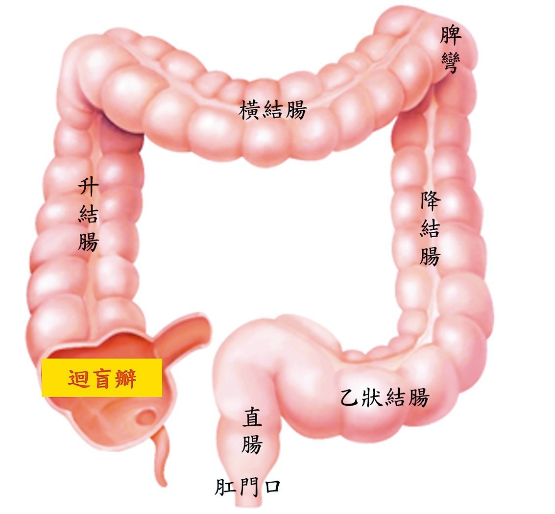右側大腸（脾彎、橫結腸、升結腸、迴盲瓣）的息肉較難檢測出來。