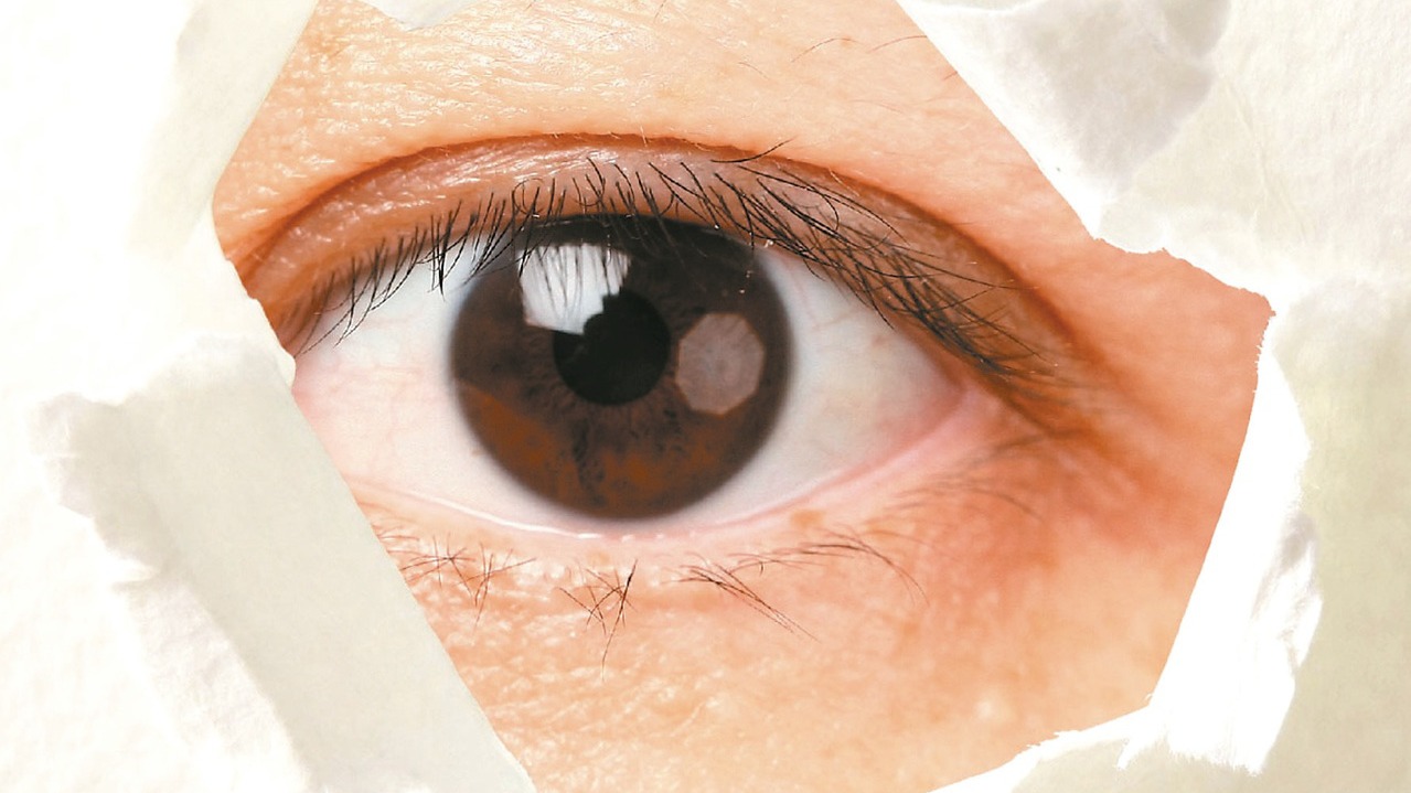 眼皮的跳動由多種因素引起，包括熬夜過勞、壓力過大或鈣離子不足導致血鈣濃度低時，也會造成眼皮不正常跳動。