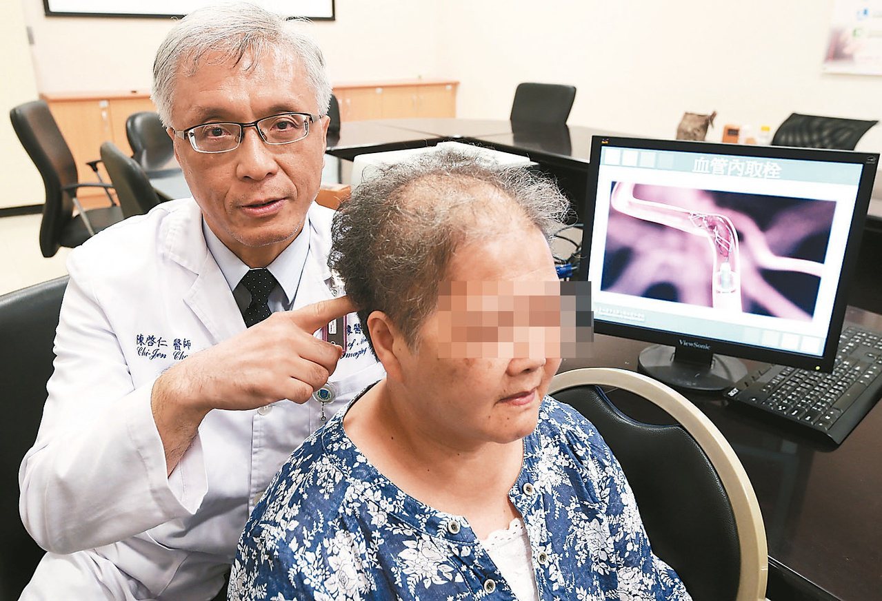 雙和醫院影像醫學部醫師陳啟仁（左），以微導管動脈取栓術，成功取出血栓。