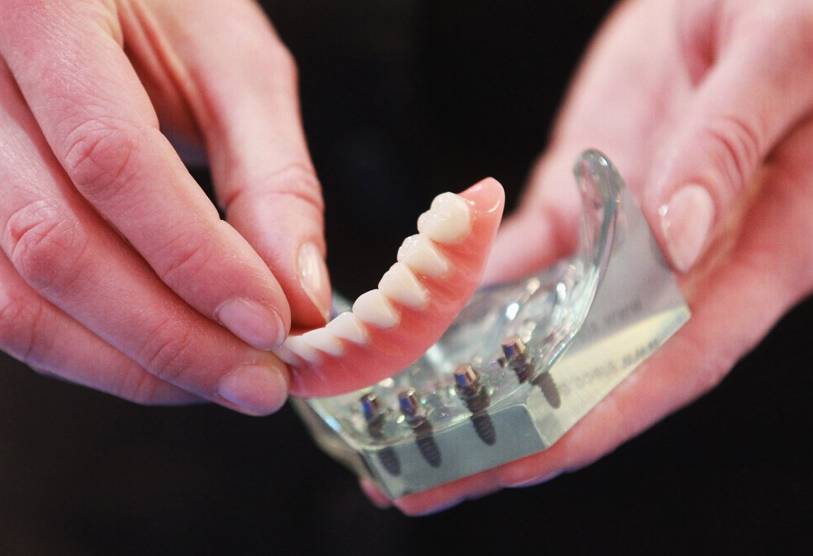 儘管花費大，想植牙者越來越多。<br />Getty Images