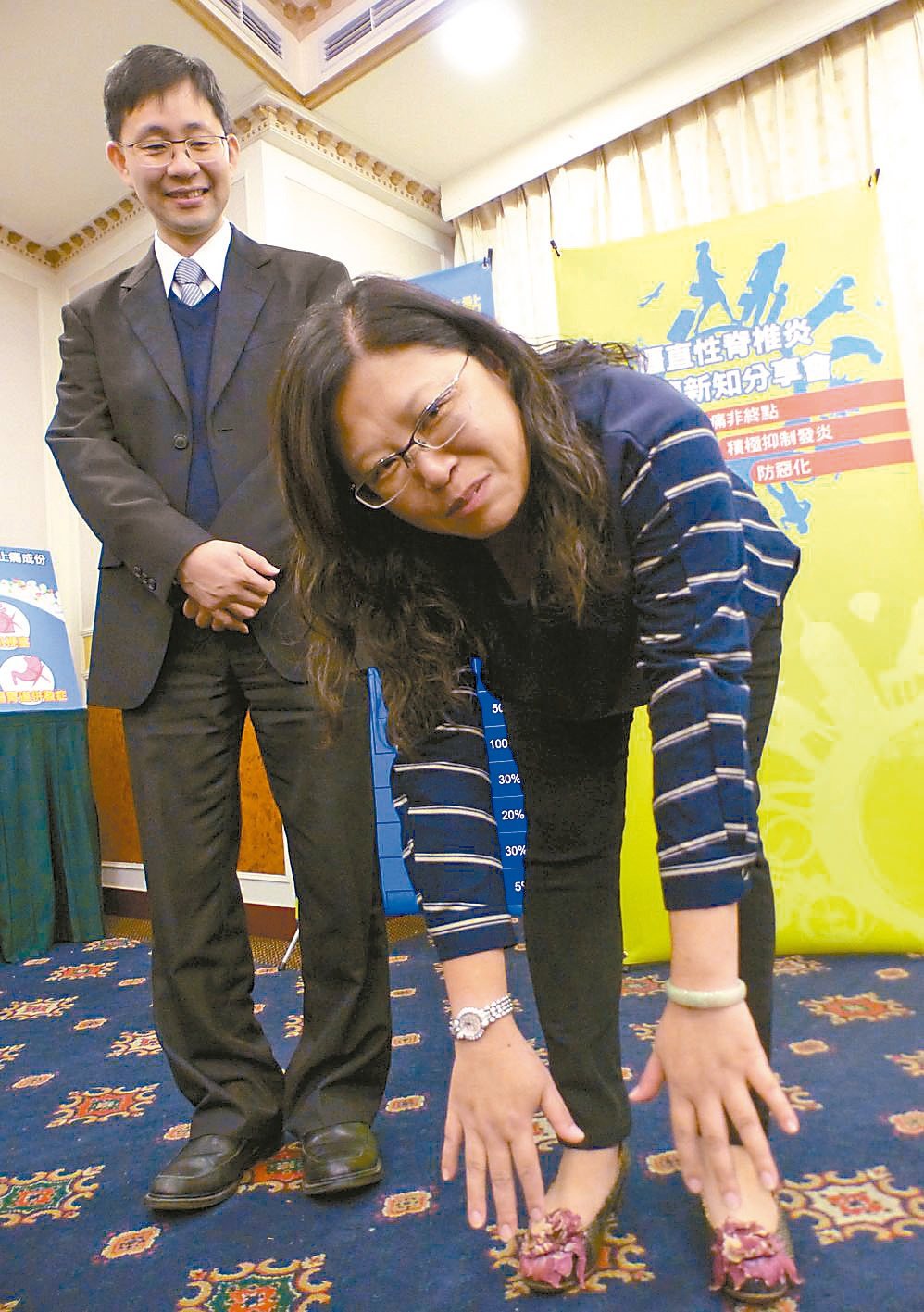 罹患僵直性脊椎炎的王姓婦人(右)，向台中榮總醫師陳信華(左)展示彎腰的動作一如常人。
