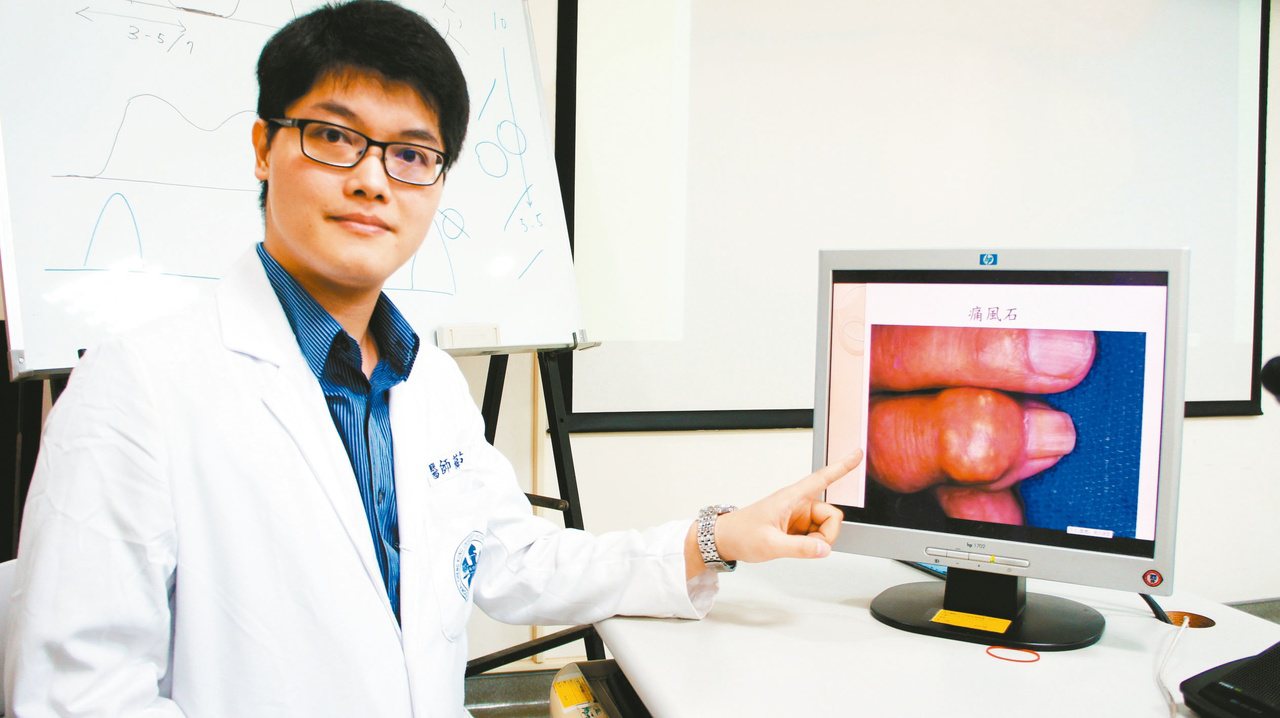 成大醫院斗六分院風濕免疫科醫師薛亘佑指出，若不控制好尿酸，有可能造成關節結石。