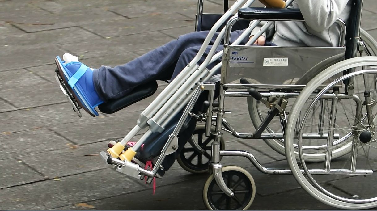 打石膏坐輪椅示意圖。報系資料照