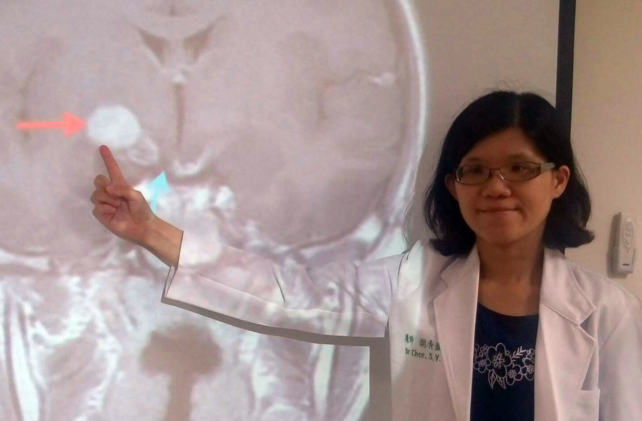 醫師謝秀盈說明，9歲男童因右側丘腦有一顆1.5公分的腦瘤（紅色箭頭處）侵犯到蝶鞍，影響腦下垂體，造成性早熟。記者趙容萱／攝影