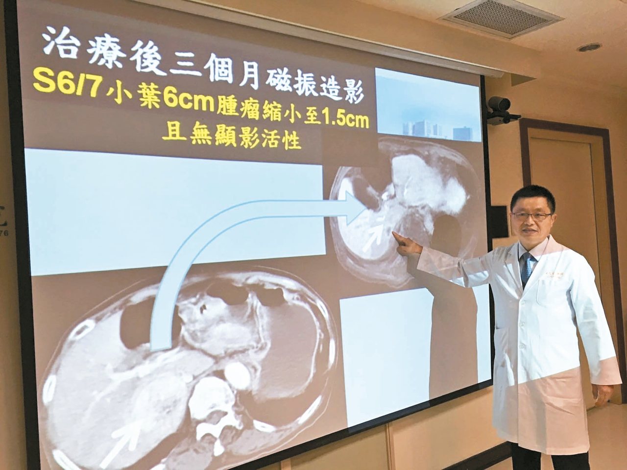林口長庚副院長洪志宏說，質子治療就像「不用手術的手術」。