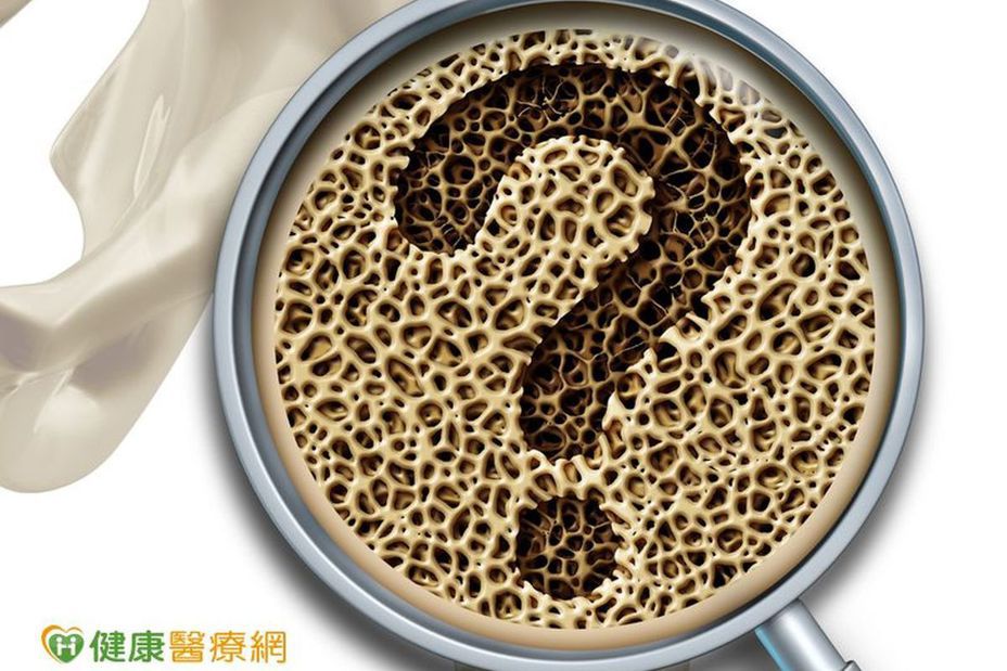 台灣髖關節骨折率居全球之首！提醒骨鬆用藥不可停，以免骨質加速流失。