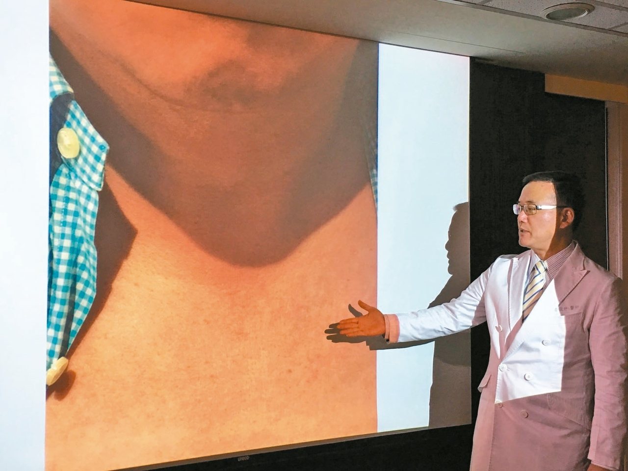 榮新診所副院長潘俊伸說明真性紅血球增生症患者臉部與頸部發紅。記者江慧珺／攝影