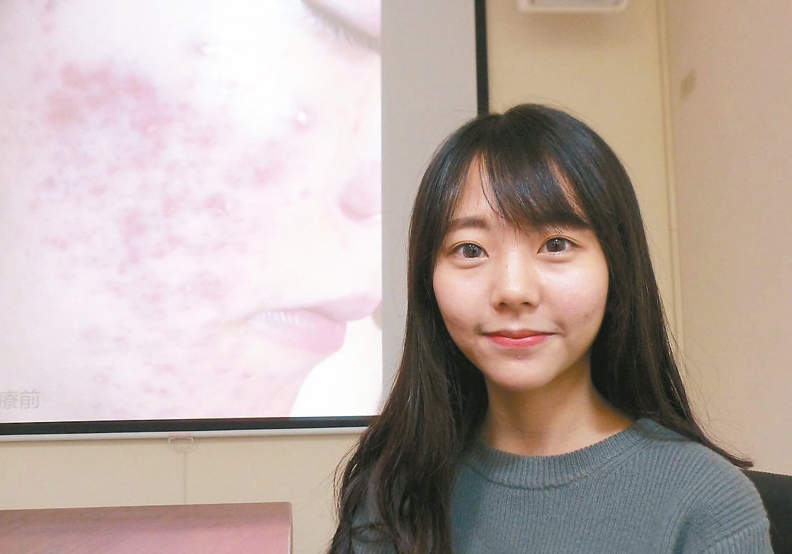 貌似韓國藝人「IU」的女學生蘇梓婷開心能擺脫「豆花妹」形象，還她美麗容顏。