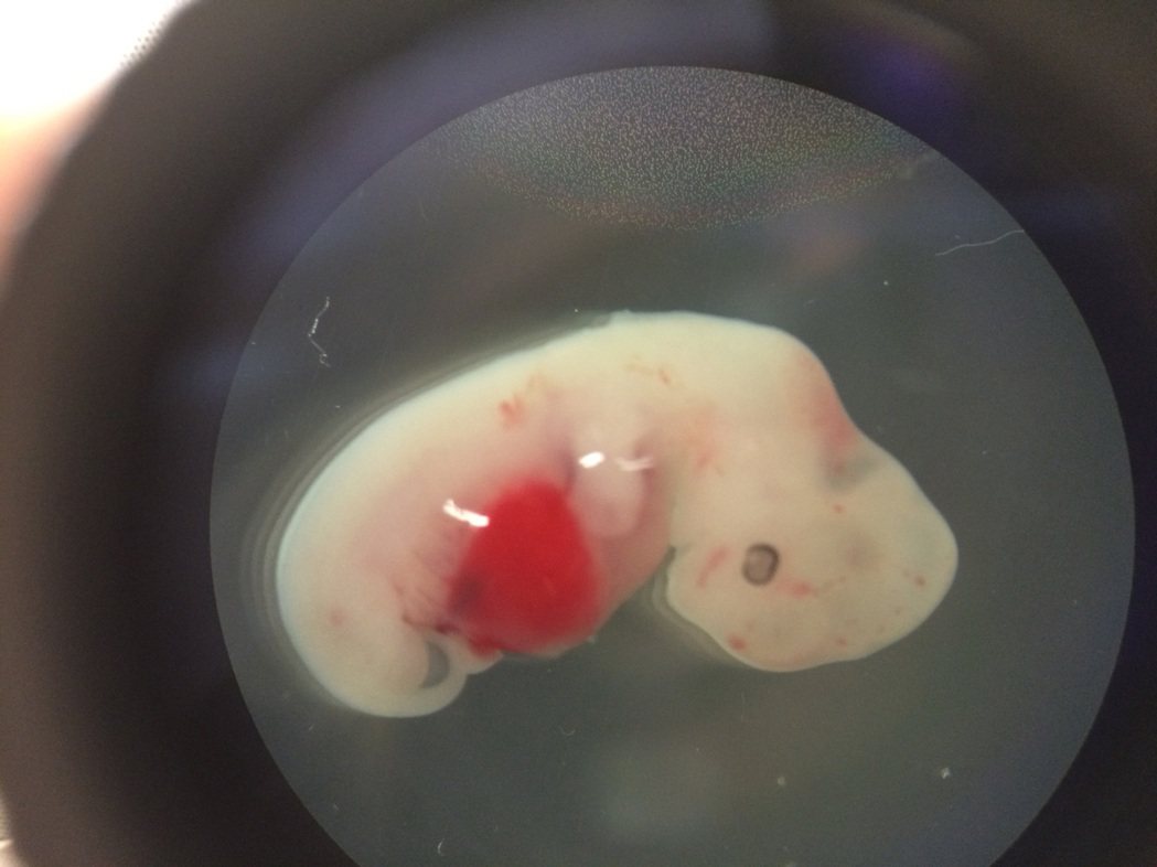 科學家首次培育出人豬混合胚胎，希望能解決全球器官短缺的問題。(美聯社)