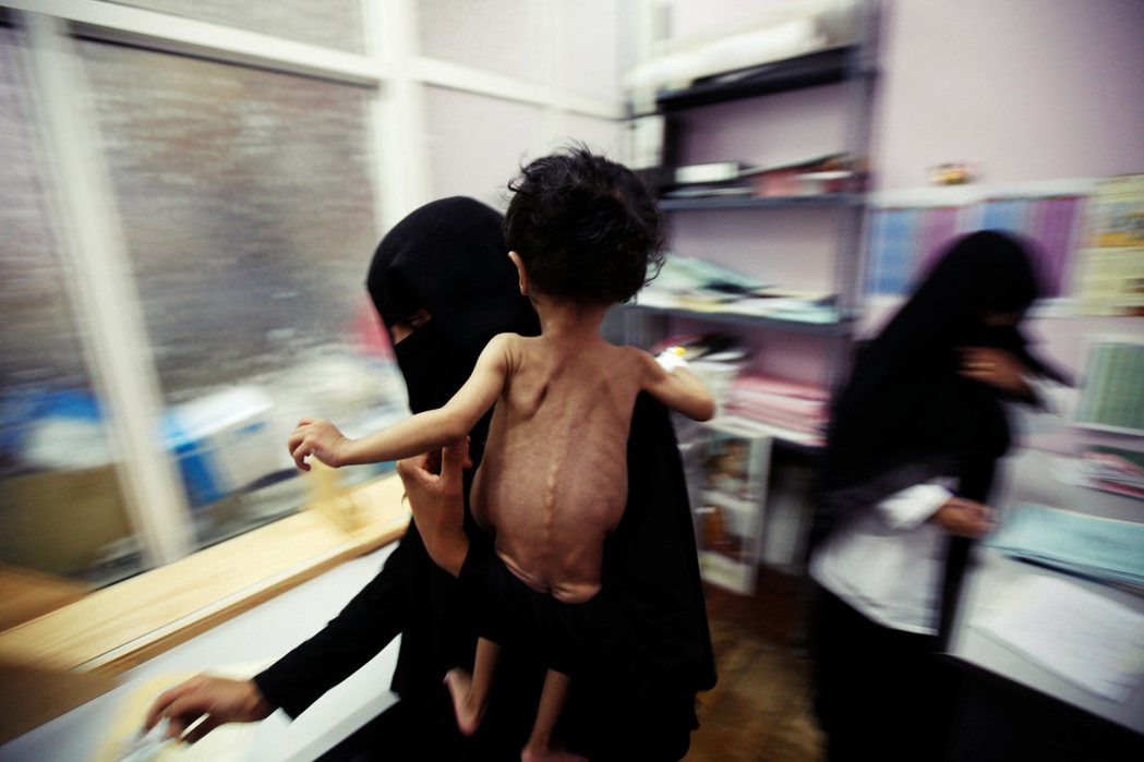 每10分鐘，就有1個葉門的孩子因饑餓而死。 圖／路透社