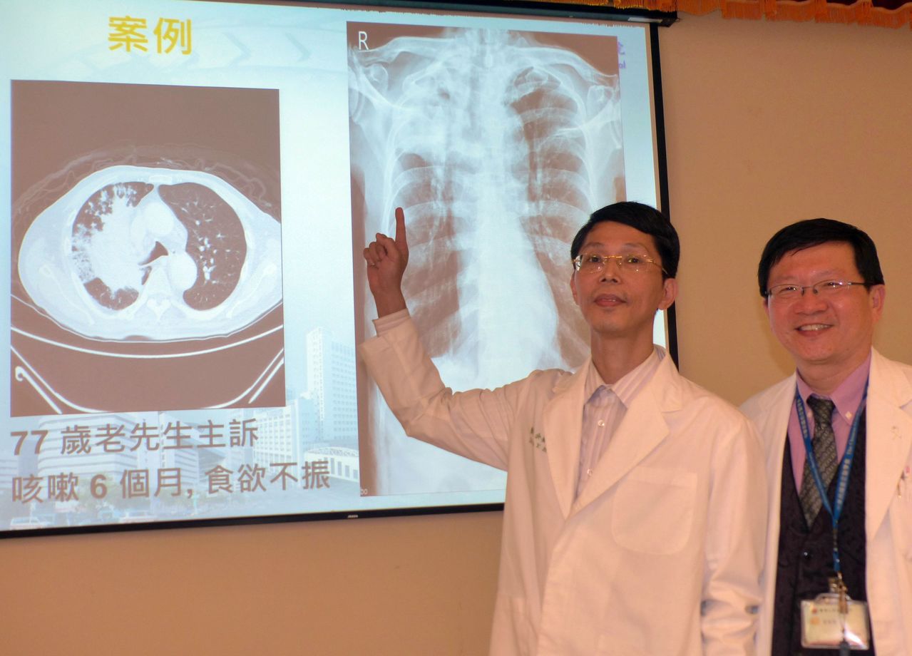 醫師余養豪（左）說明，77歲老翁就診發現右上肺葉萎縮（右圖），轉診切片檢查，確認為肺癌三期（左圖）。記者趙容萱／攝影