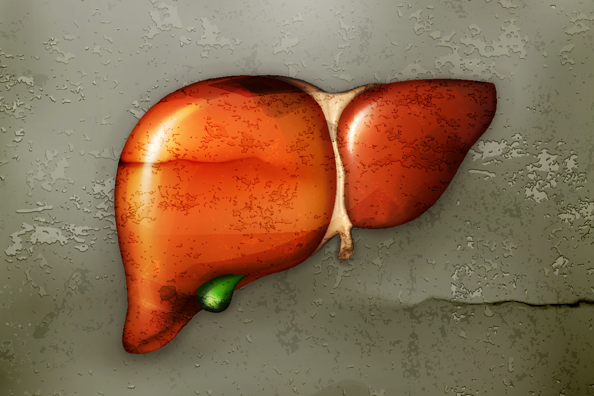 很多人健檢發現患有脂肪肝合併肝炎，反應都是「沒變成癌症就好」，不再後續追蹤。<br />圖／ingimage