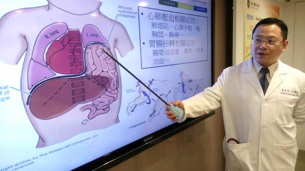台北醫學大學附設醫院急症外傷外科主任黃宏昌（圖）3日表示，橫隔膜是分隔胸腔與腹腔的一層肌肉組織，若橫隔膜產生病變，橫隔膜無法有效發揮「隔間」功能就會出問題。（北醫附醫提供）