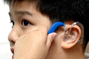 助聽器還是電子耳？聽障者們：我要什麼樣的身體