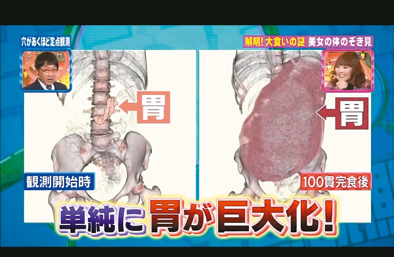 圖左是未進食的胃，圖右為吃下一百貫壽司後胃部脹大的情形。