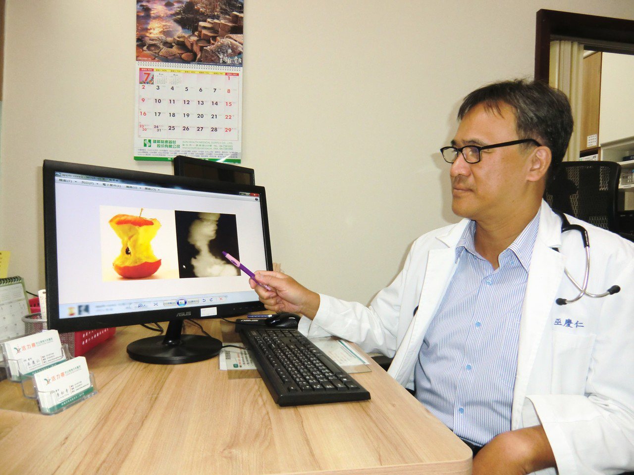 內科醫師巫慶仁表示，他收治一名56歲父親因警覺性高及早做了大腸癌檢查，結果從腸道攝影照出的腫瘤有如蘋果核。記者蔡容喬／攝影