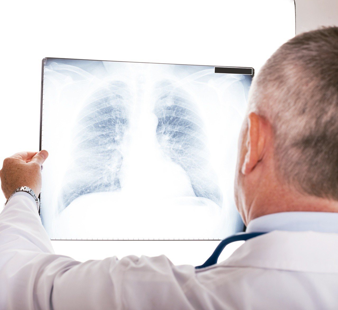 肺炎在老人家的身上致死率高，最好的方式就是從源頭預防感染。<br />圖／元氣周報