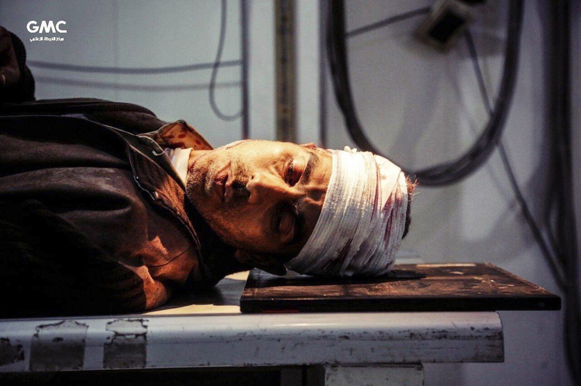 東烏塔的平民傷者。 圖／美聯社