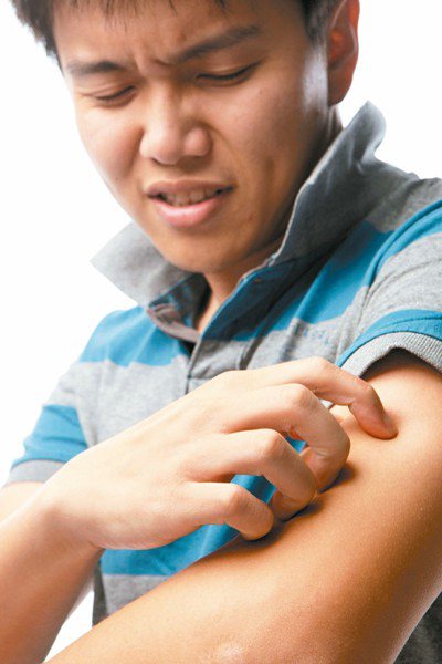 感染疥瘡皮膚表面可能出現紅斑、丘疹、水皰等，亦可能合併因劇癢抓傷引起的疼痛及細菌...
