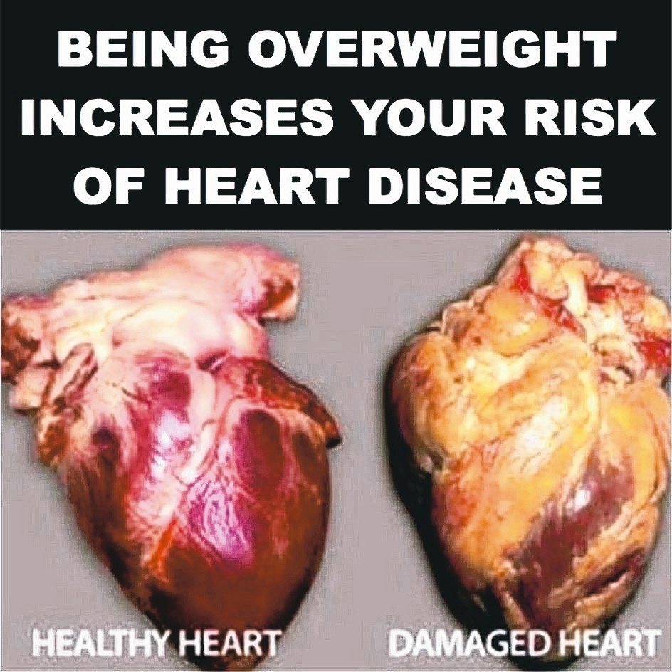 警示圖片能讓消費者更有自制力，降低衝動消費。圖片標語為「體重過重會提高心臟病風險」。