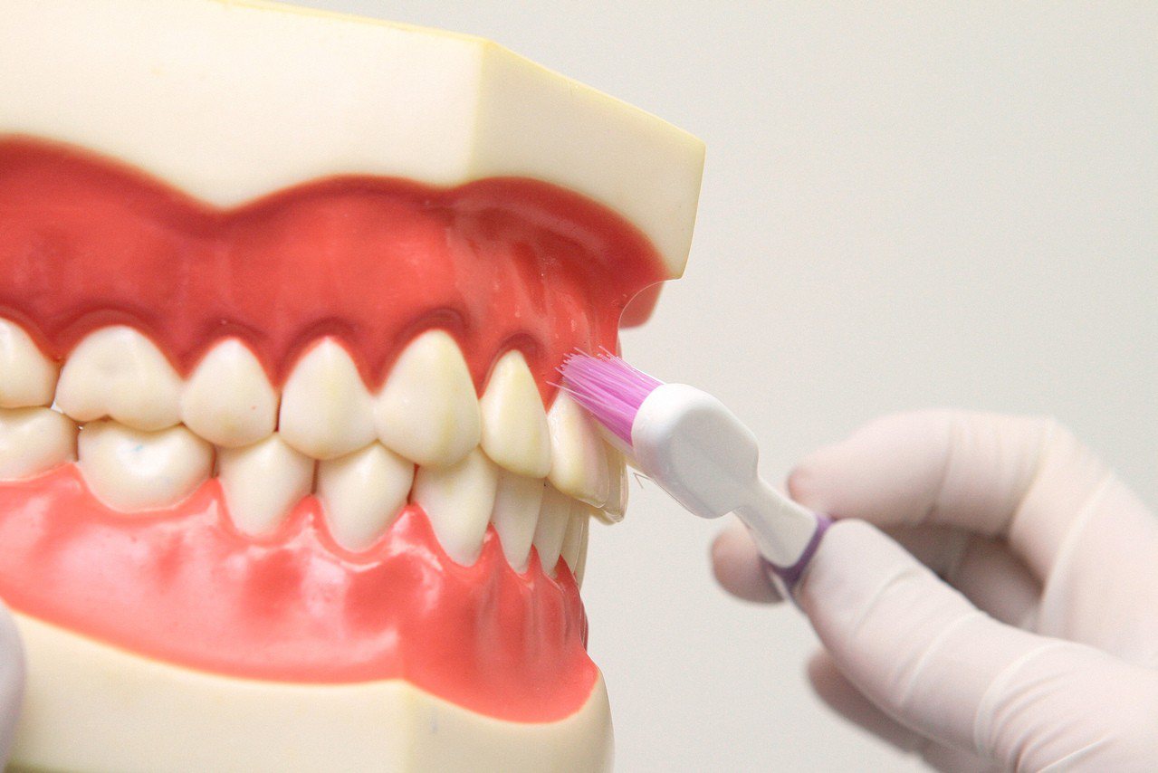 要了解自己牙齦的健康狀態，最簡單的方法就是觀察「牙齦的顏色」。