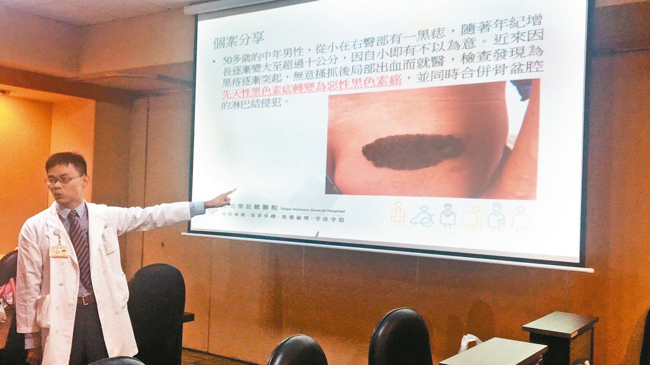 台北榮總皮膚部主治醫師李政源說，我國黑色素瘤每年約有200多個新病例，病灶最常長在手足。