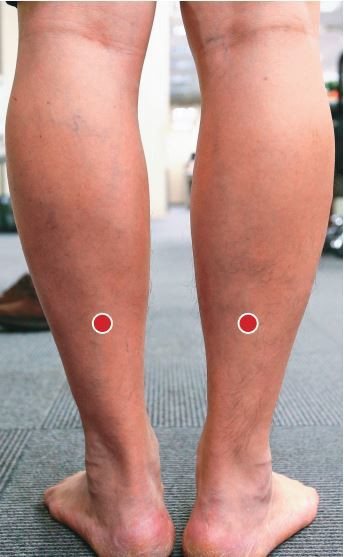承山穴位置在小腿後面正中，可用大拇指進行自我按摩，左右腿各1至3分鐘，以舒緩腳抽筋。