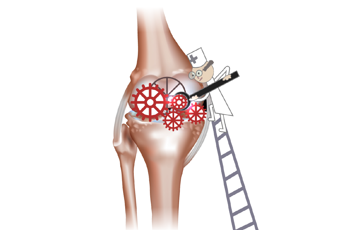 除了老化，退化性關節炎跟工作、負重、體重、姿勢等都有關，如果要預防或延緩退化性關節炎，平常應該加強膝蓋周邊的肌肉訓練，透過肌肉力量減少膝蓋負擔。<br />圖／123RF