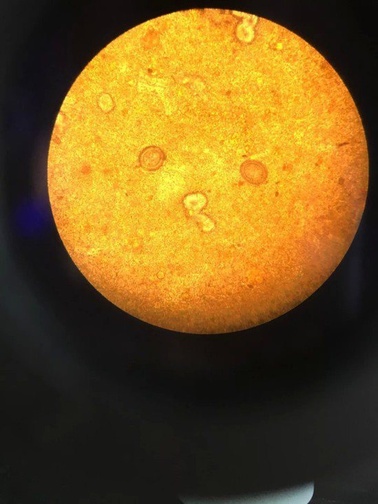 第二次於省疾控的糞檢壓片的顯微鏡圖，其中圓球體為絛蟲蟲卵。