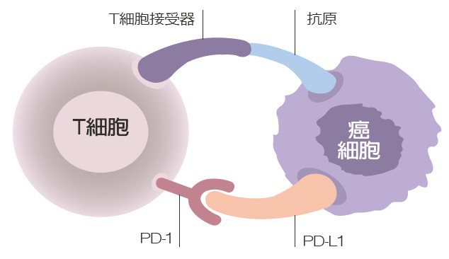 圖一
左邊是T細胞，右邊是癌細胞。T細胞可識別癌細胞並攻擊。但癌細胞很狡猾，當它看到T細胞上的PD-1蛋白，可伸出一個PD-L1蛋白，當PD-1與PD-L1結合，提供抑制信號，誘導T細胞凋亡。