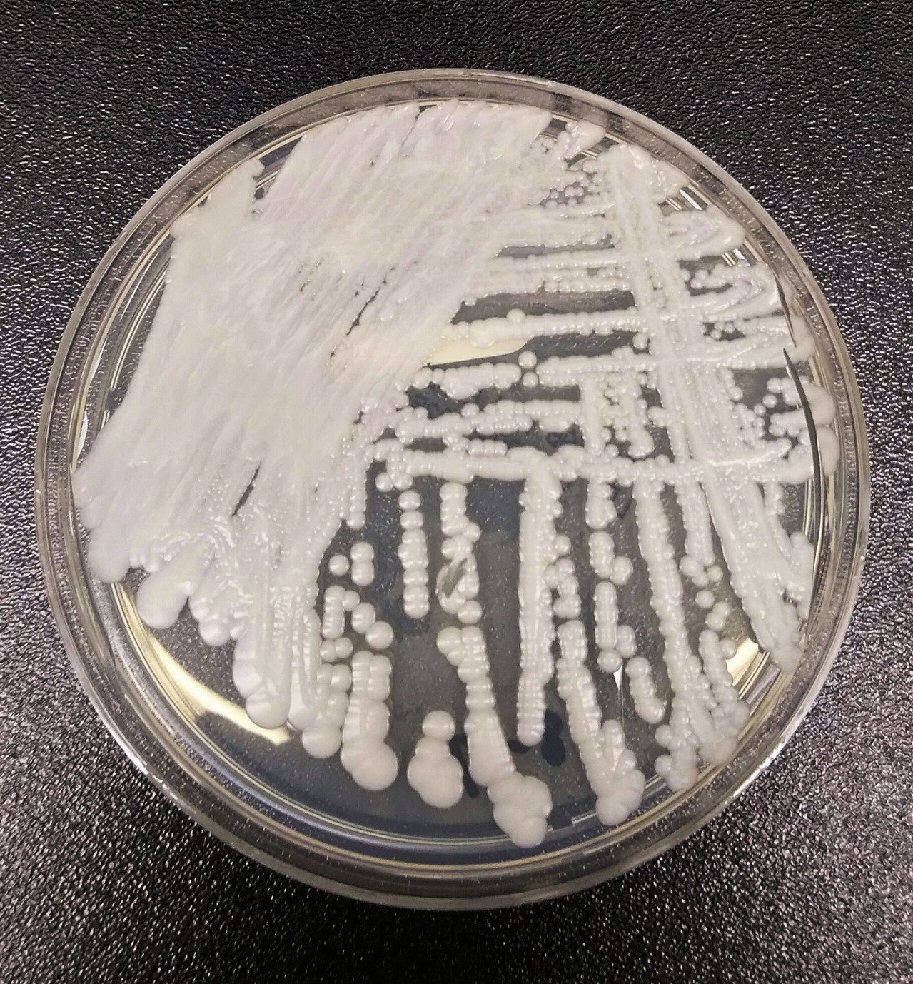 美國疾病防治中心(CDC)一個實驗室在培養皿中培養出的「耳念珠菌」(Candida auris)。美聯社