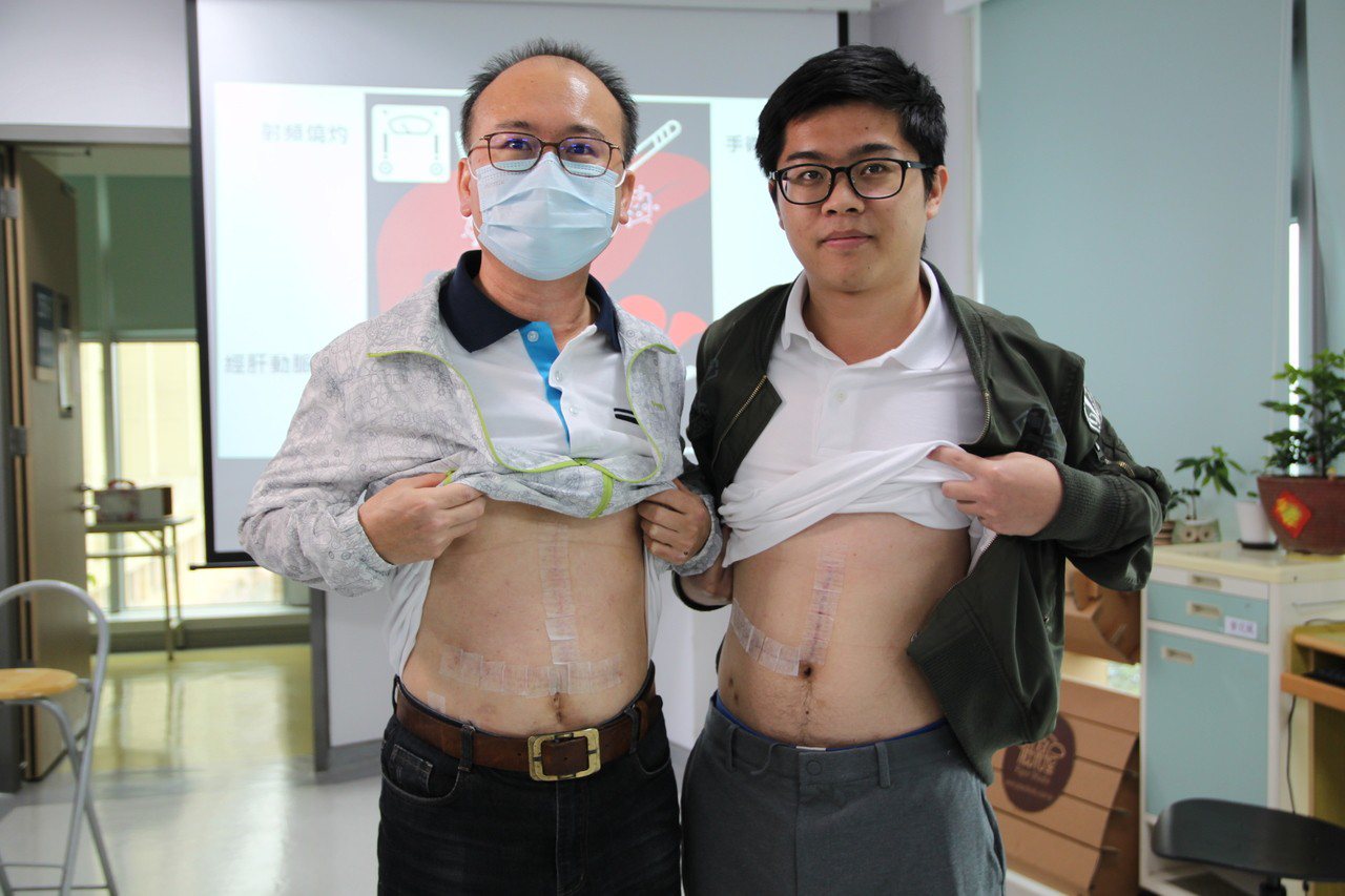肝癌患者林世東（左）喜獲兒子林雲笙換肝給他，得以獲得新生。記者黃寅／攝影