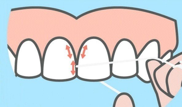 用牙線清潔牙齒時，每個牙縫要貼著牙齒，左、右各清一次。圖／取自網路
