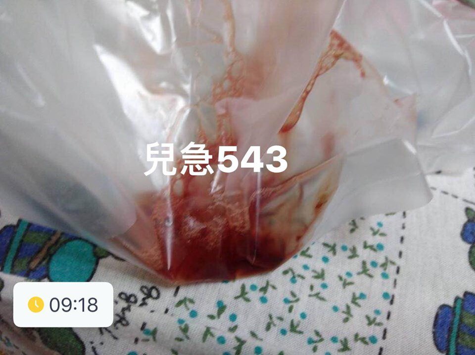 5歲男童去年誤食鹼粽水後，不斷吐出鮮血。圖／擷取自來講兒科急診的543-吳昌騰醫師臉書粉絲頁